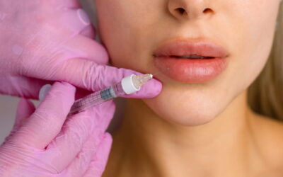 Filler labbra: costi, vantaggi e rischi