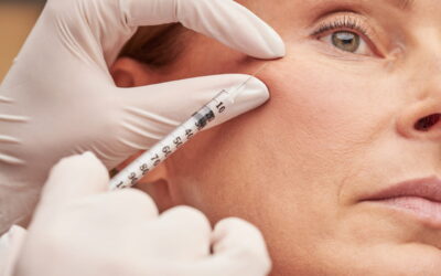 Botox: benefici e falsi miti da sfatare